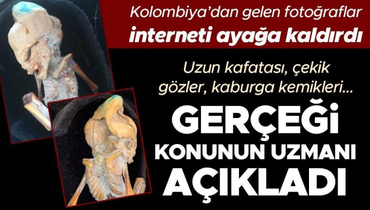 Kolombiya’dan gelen fotoğraflar interneti ayağa kaldırdı! Uzun kafatası, çekik gözler, kaburga kemikleri… Gerçeği konunun uzmanı açıkladı